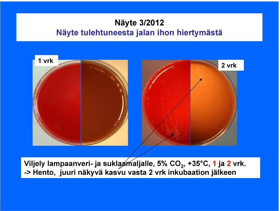 suklaamaljalle, 5% CO 2, +35 C, 1 ja 2 vrk.