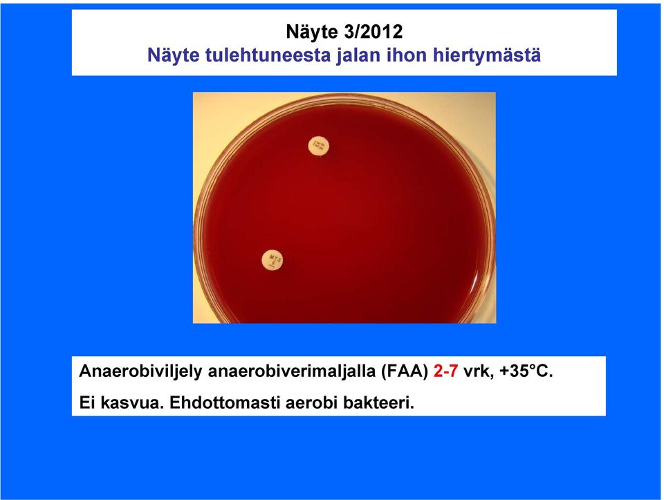 anaerobiverimaljalla (FAA) 2-7 vrk,