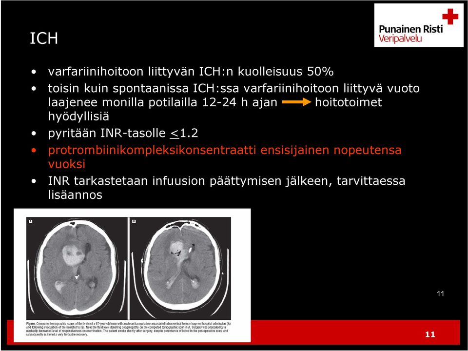 hyödyllisiä pyritään INR-tasolle <1.