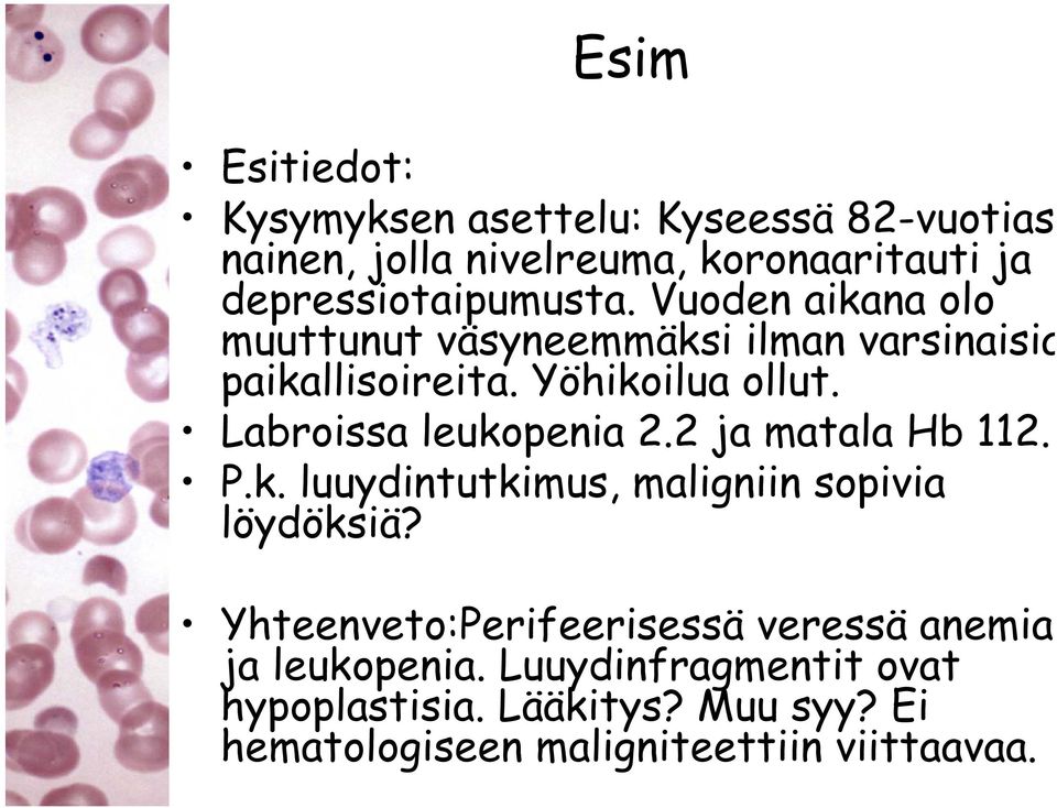 Labroissa leukopenia 2.2 ja matala Hb 112. P.k. luuydintutkimus, maligniin sopivia löydöksiä?