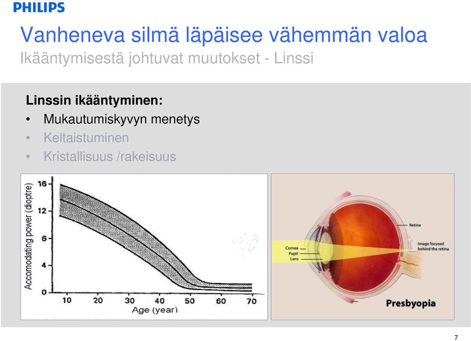 Linssin ikääntyminen: Mukautumiskyvyn menetys