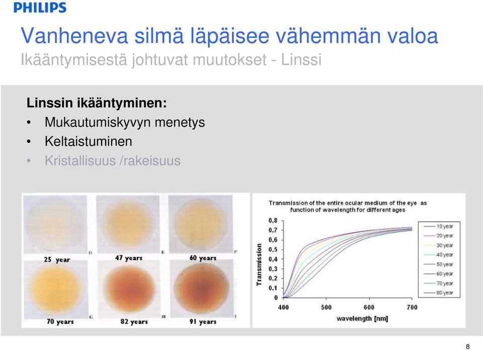 Linssin ikääntyminen: Mukautumiskyvyn menetys