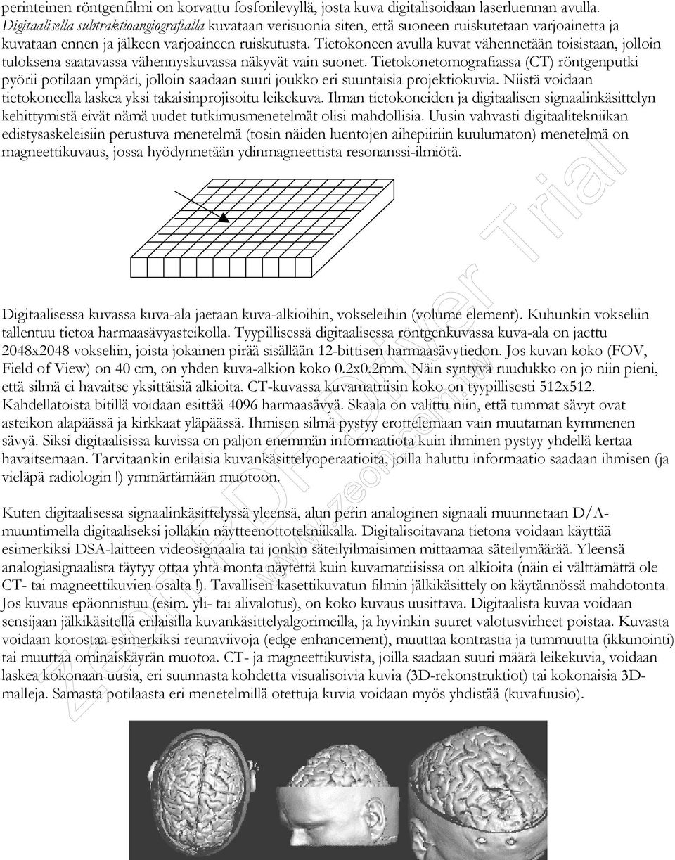 Tietokoneen avulla kuvat vähennetään toisistaan, jolloin tuloksena saatavassa vähennyskuvassa näkyvät vain suonet.