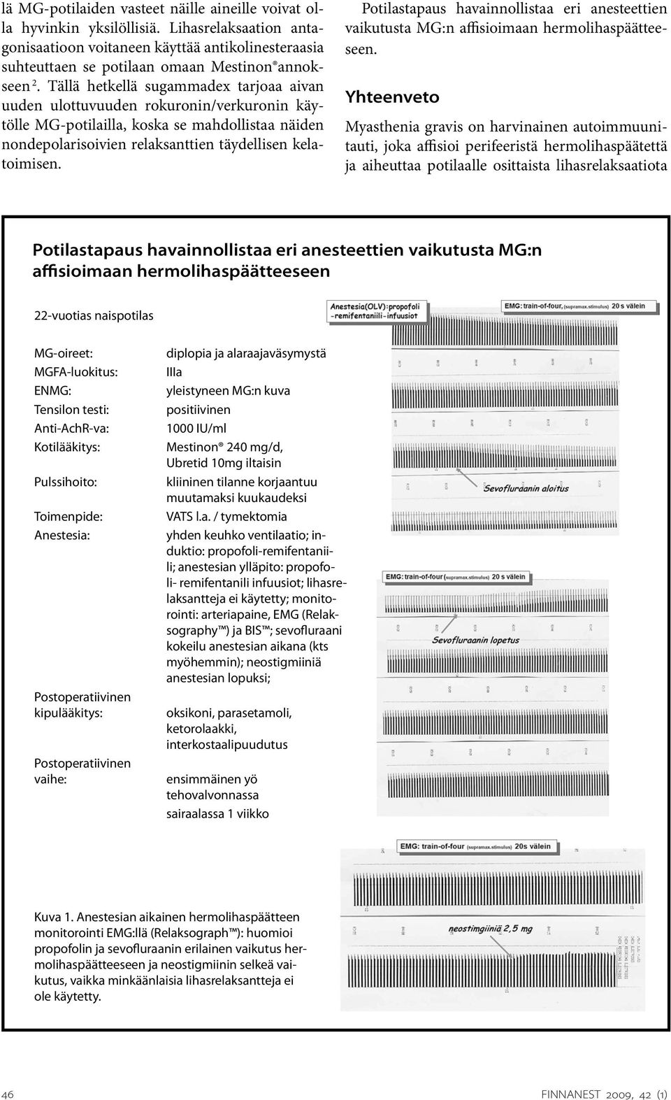 Potilastapaus havainnollistaa eri anesteettien vaikutusta MG:n affisioimaan hermolihaspäätteeseen.