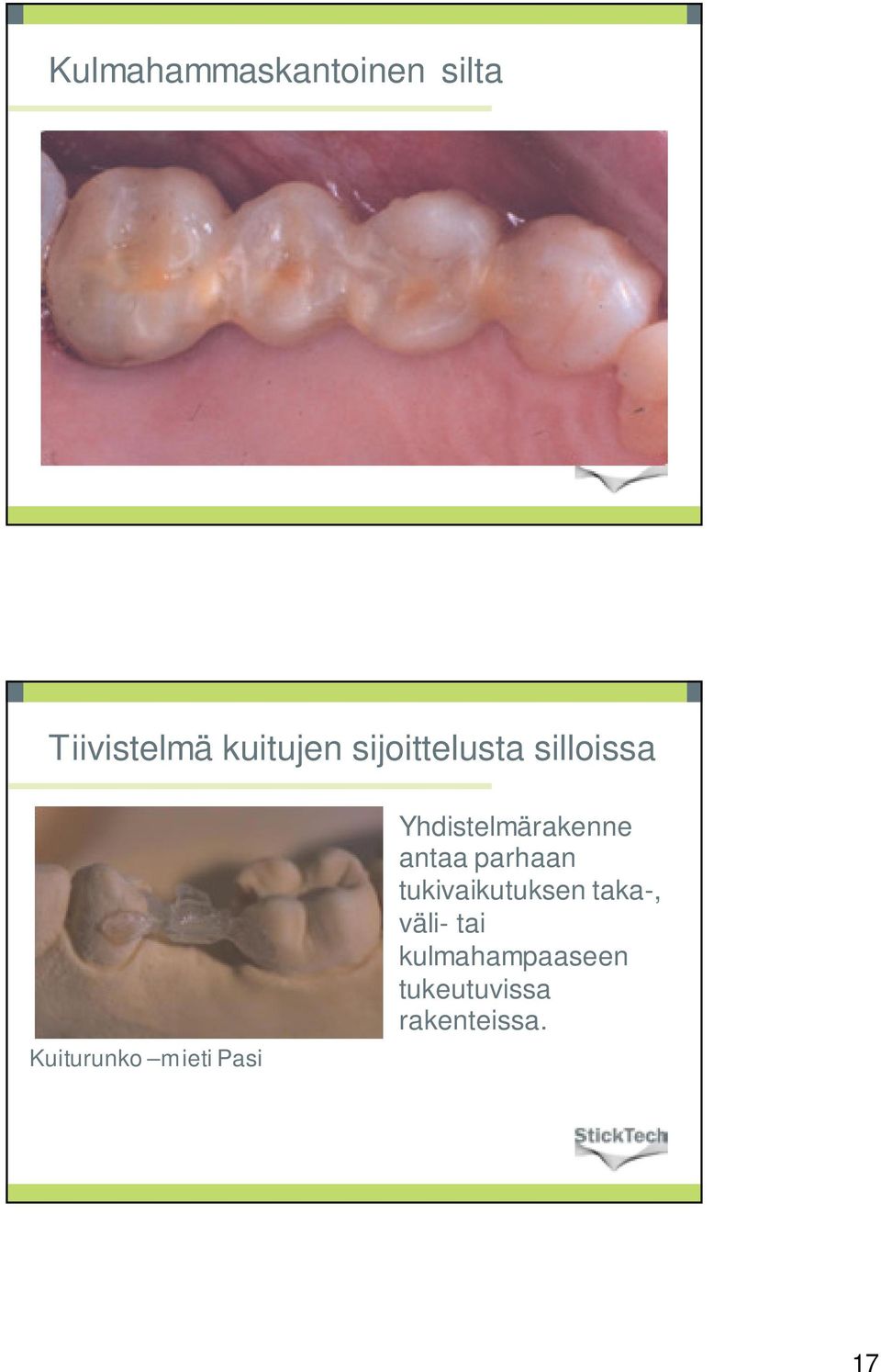 Yhdistelmärakenne antaa parhaan tukivaikutuksen