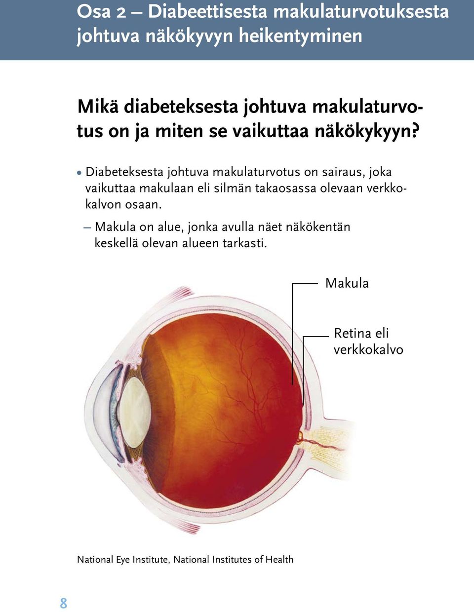 Diabeteksesta johtuva makulaturvotus on sairaus, joka vaikuttaa makulaan eli silmän takaosassa olevaan