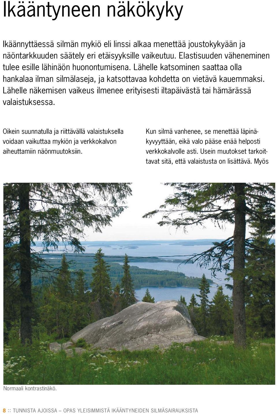 Lähelle näkemisen vaikeus ilmenee erityisesti iltapäivästä tai hämärässä valaistuksessa.