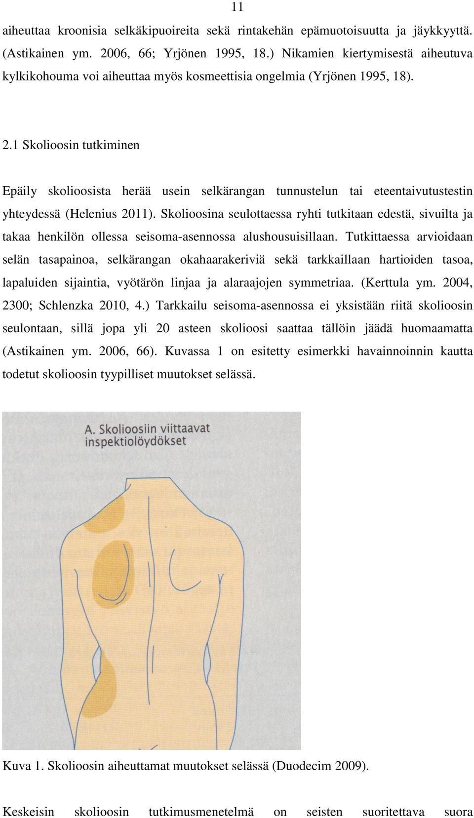1 Skolioosin tutkiminen Epäily skolioosista herää usein selkärangan tunnustelun tai eteentaivutustestin yhteydessä (Helenius 2011).