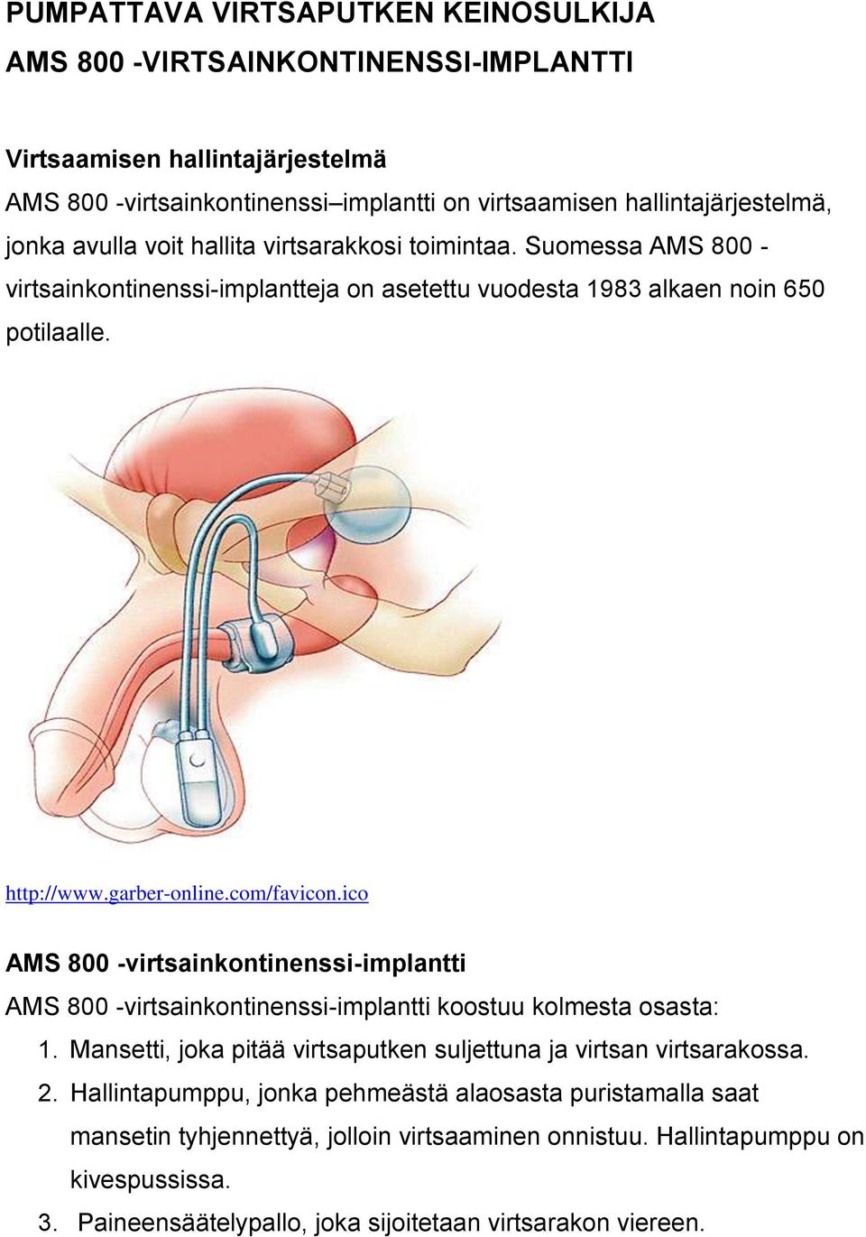 ico AMS 800 -virtsainkontinenssi-implantti AMS 800 -virtsainkontinenssi-implantti koostuu kolmesta osasta: 1. Mansetti, joka pitää virtsaputken suljettuna ja virtsan virtsarakossa. 2.