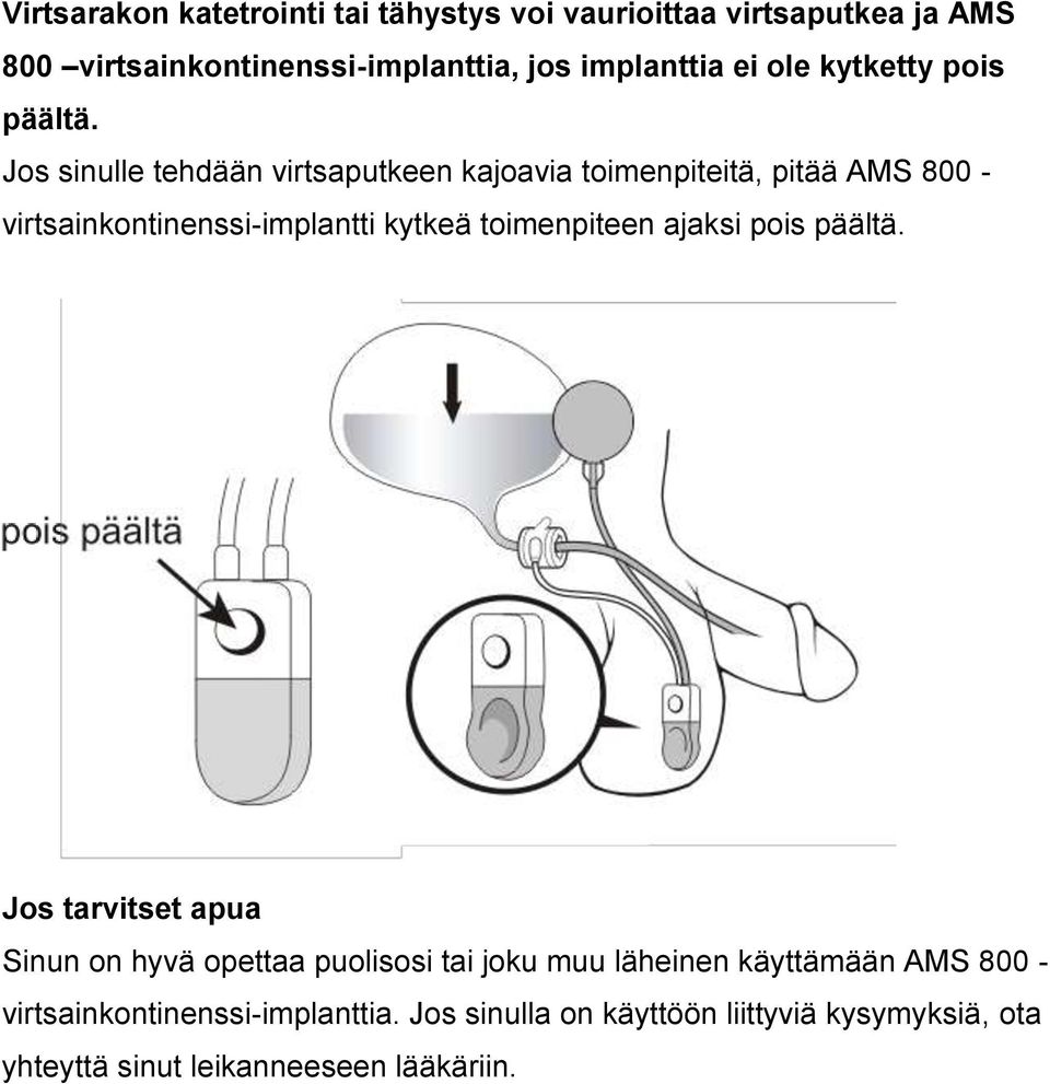 Jos sinulle tehdään virtsaputkeen kajoavia toimenpiteitä, pitää AMS 800 - virtsainkontinenssi-implantti kytkeä toimenpiteen