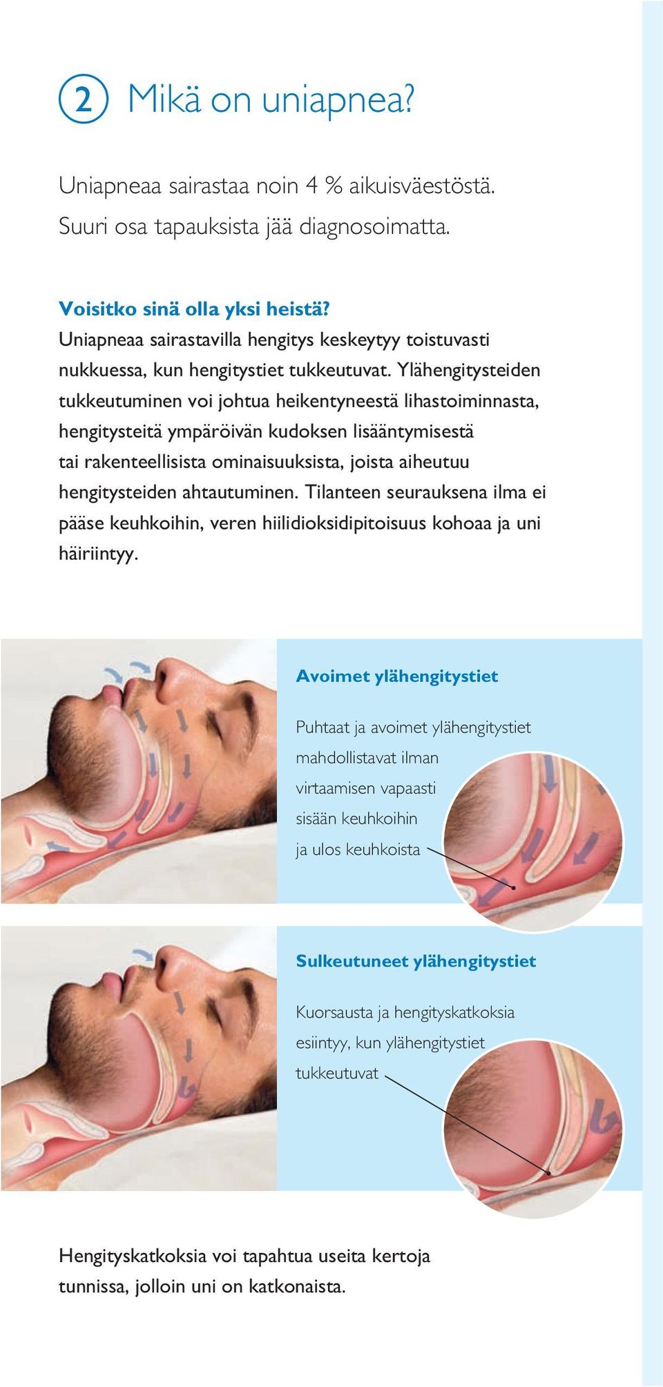 Ylähengitystden tukkeutuminen voi johtua hkentyneestä lihastoiminnasta, hengitysttä ympäröivän kudoksen lisääntymisestä tai rakenteellisista ominaisuuksista, joista aiheutuu hengitystden ahtautuminen.