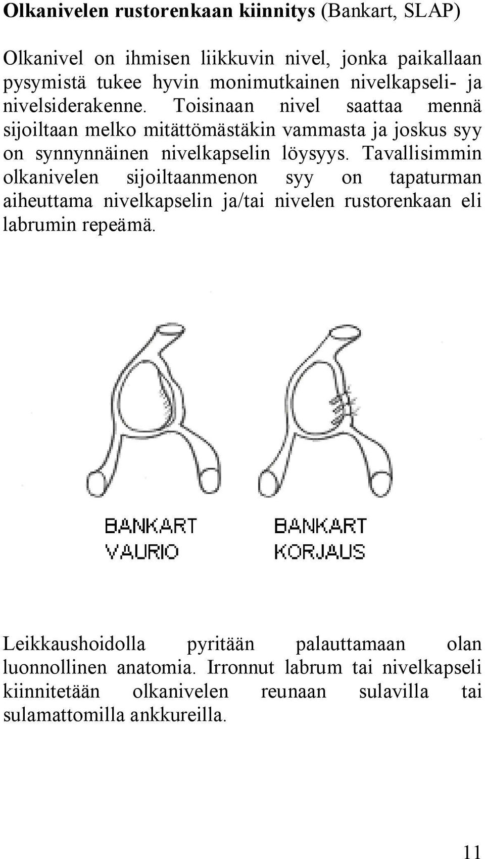 Toisinaan nivel saattaa mennä sijoiltaan melko mitättömästäkin vammasta ja joskus syy on synnynnäinen nivelkapselin löysyys.