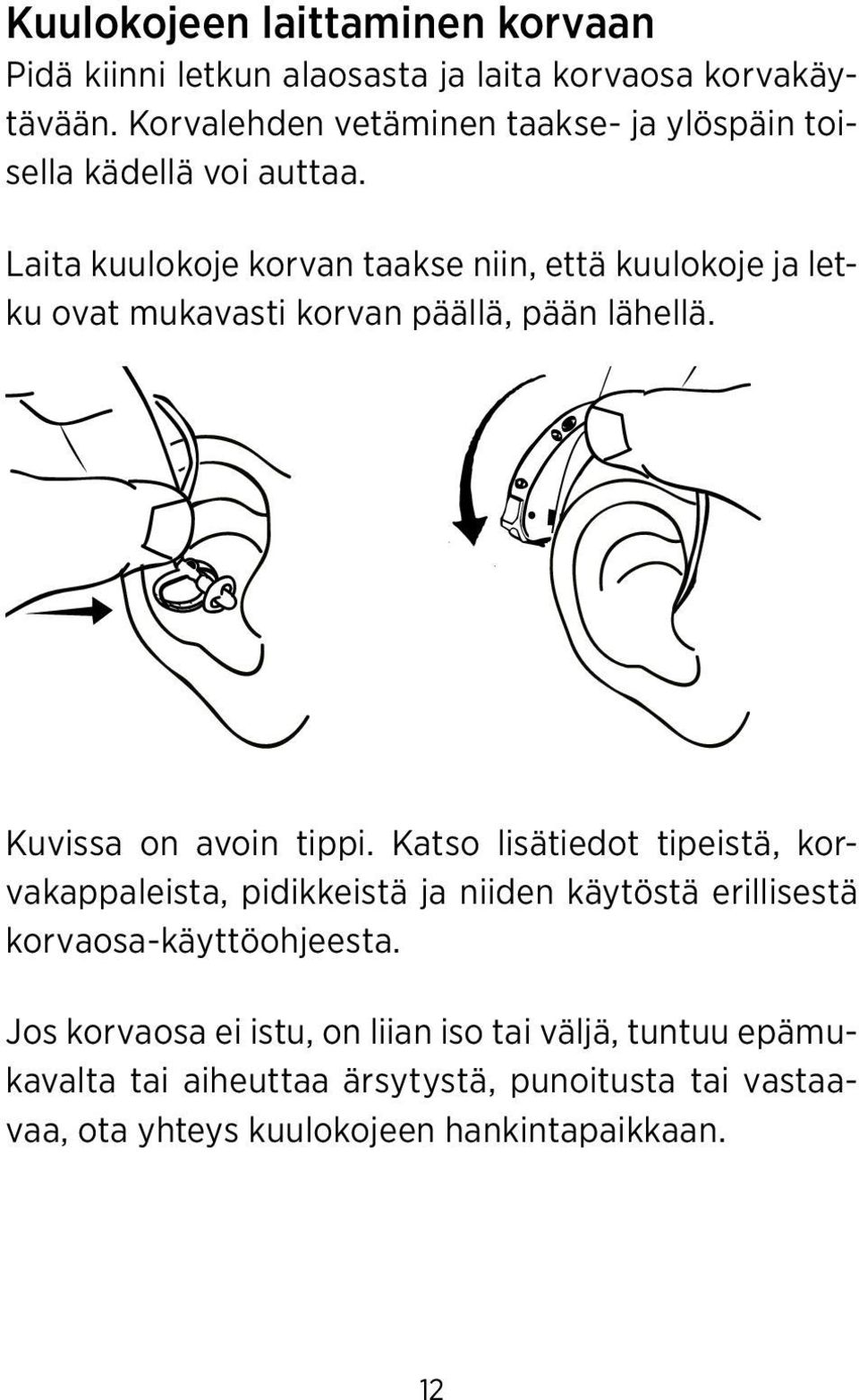 Laita kuulokoje korvan taakse niin, että kuulokoje ja letku ovat mukavasti korvan päällä, pään lähellä. Kuvissa on avoin tippi.