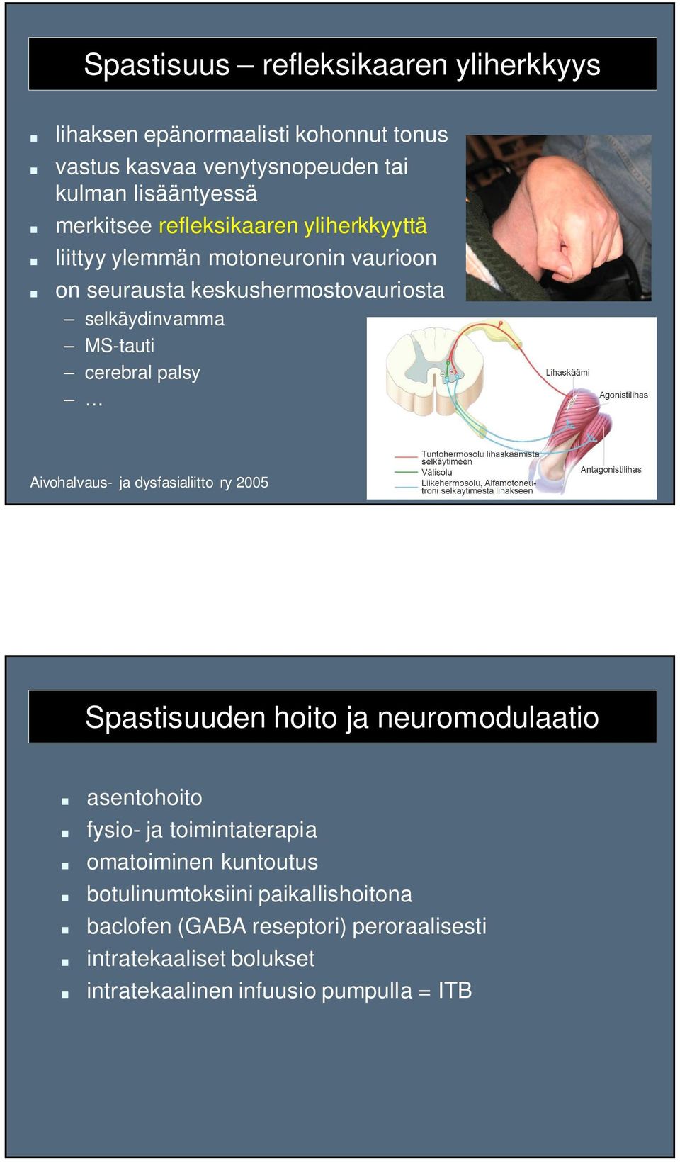 palsy Aivohalvaus- ja dysfasialiitto ry 2005 Spastisuuden hoito ja neuromodulaatio asentohoito fysio- ja toimintaterapia omatoiminen