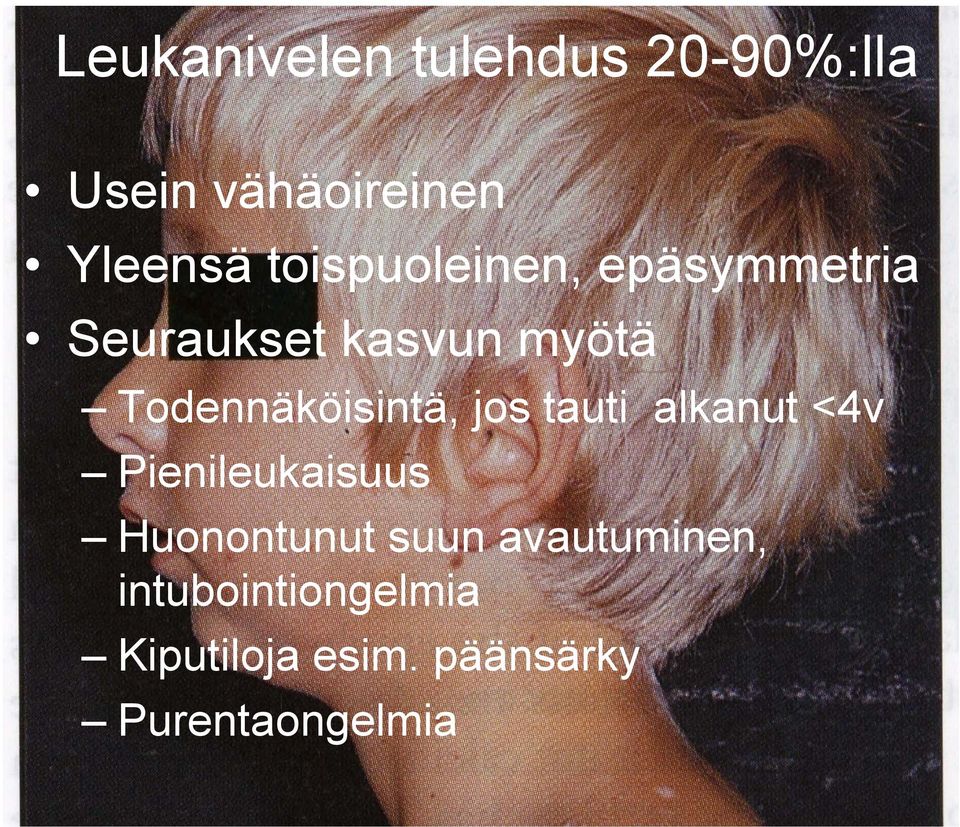 Todennäköisintä, jos tauti alkanut <4v Pienileukaisuus