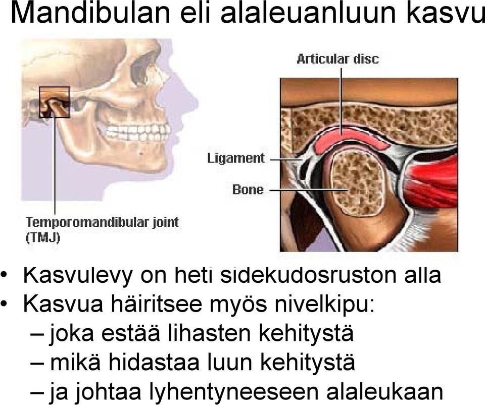 nivelkipu: joka estää lihasten kehitystä mikä