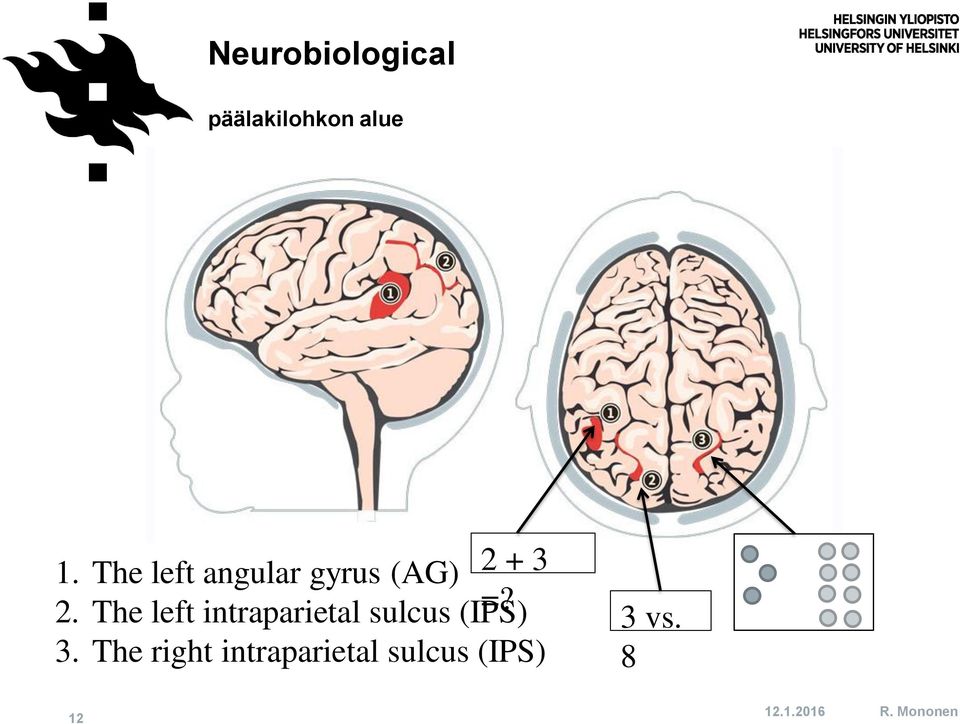 The left intraparietal sulcus (IPS) =? 3.