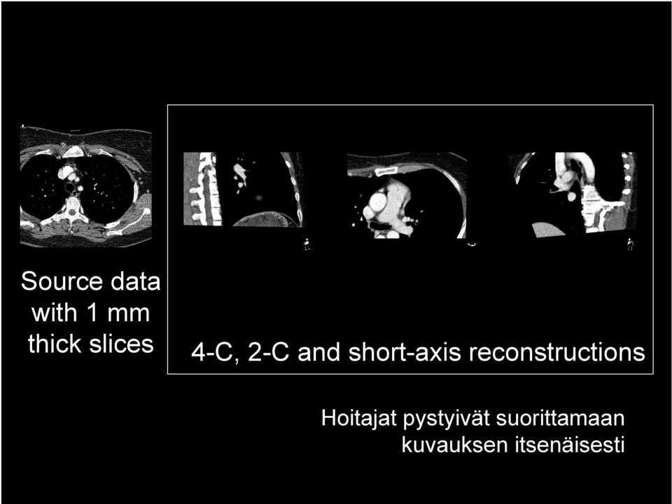 reconstructions Hoitajat