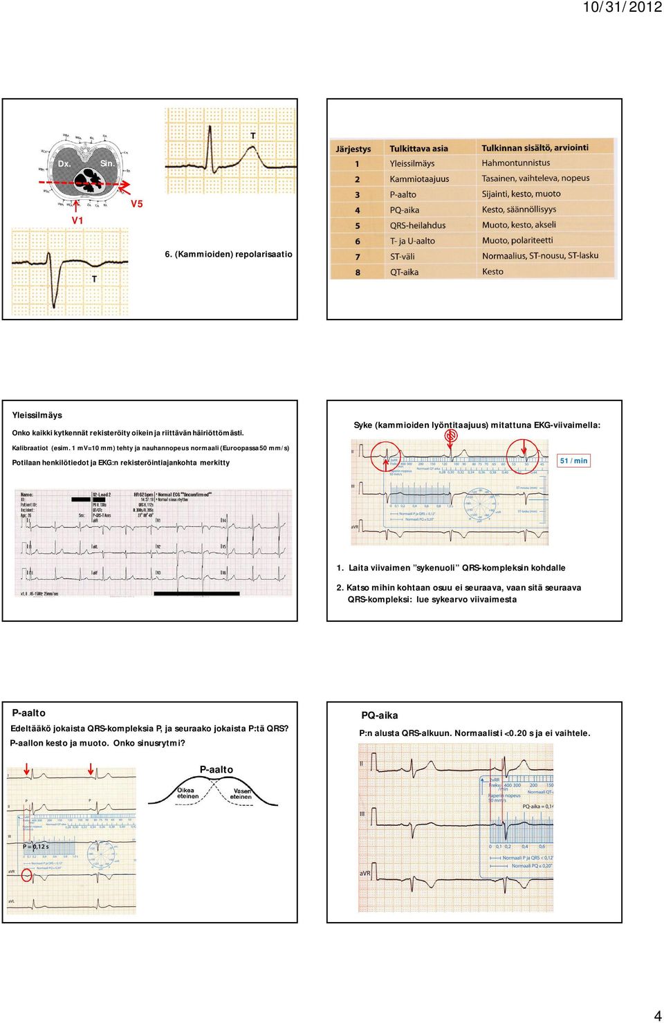 EKG-viivaimella: 51 /min 1 Laita viivaimen sykenuoli -kompleksin kohdalle 2 Katso mihin kohtaan osuu ei seuraava, vaan sitä seuraava -kompleksi: lue sykearvo