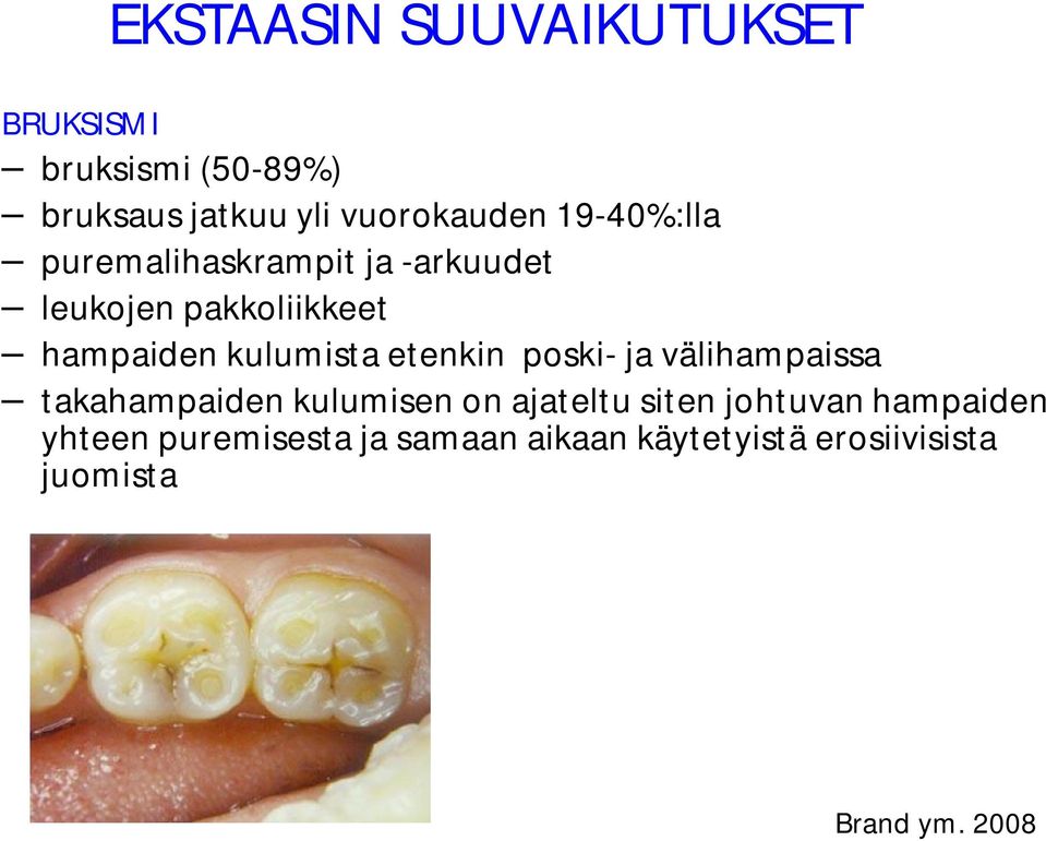 etenkin poski- ja välihampaissa takahampaiden kulumisen on ajateltu siten johtuvan