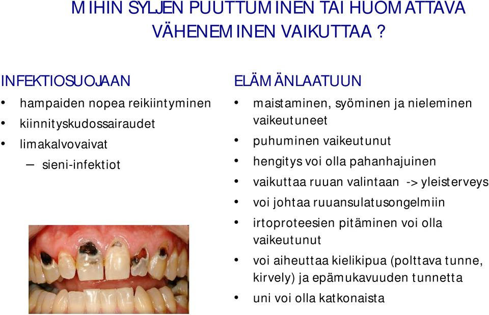 maistaminen, syöminen ja nieleminen vaikeutuneet puhuminen vaikeutunut hengitys voi olla pahanhajuinen vaikuttaa ruuan