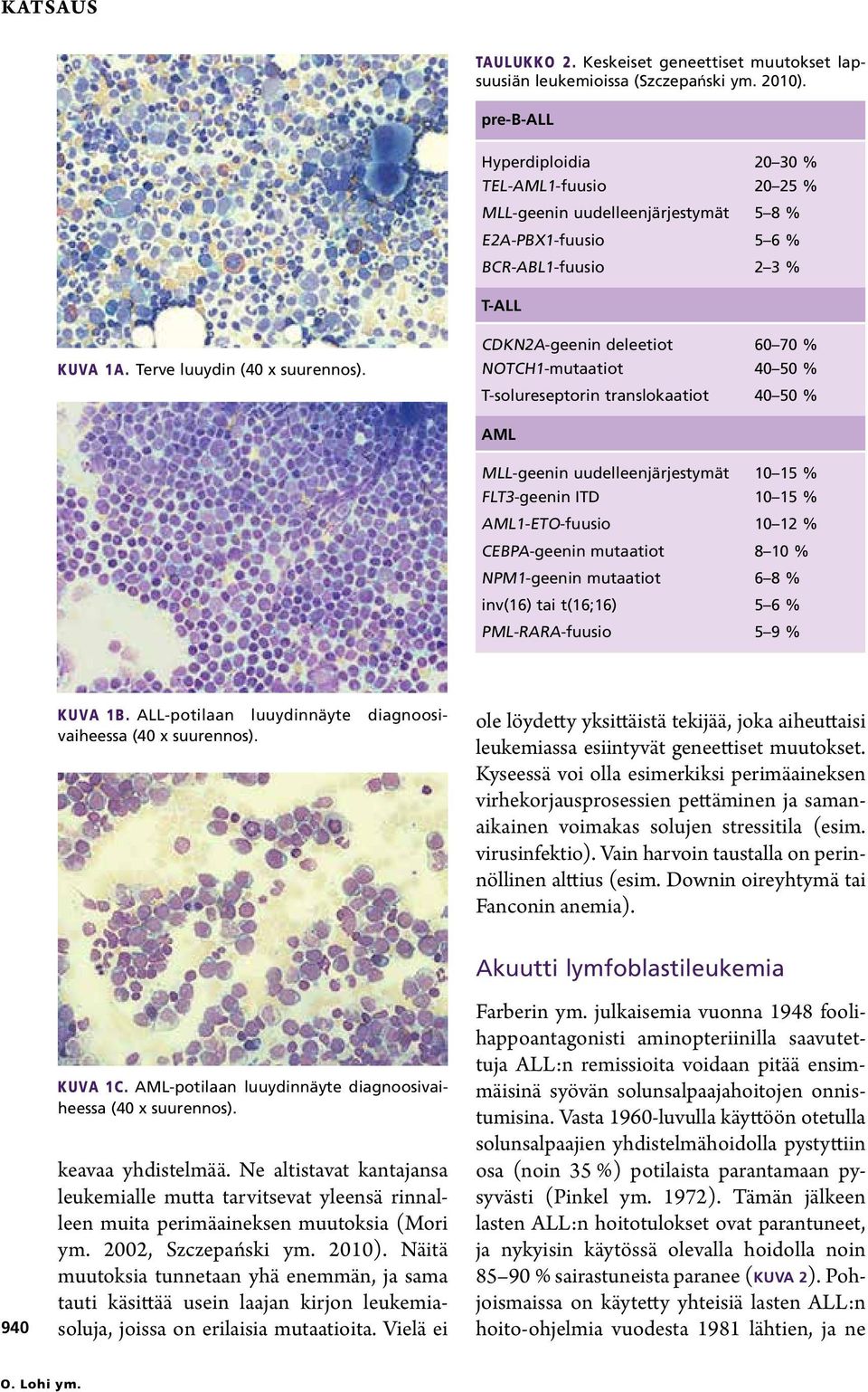 CDKN2A-geenin deleetiot 60 70 % NOTCH1-mutaatiot 40 50 % T-solureseptorin translokaatiot 40 50 % AML MLL-geenin uudelleenjärjestymät 10 15 % FLT3-geenin ITD 10 15 % AML1-ETO-fuusio 10 12 %