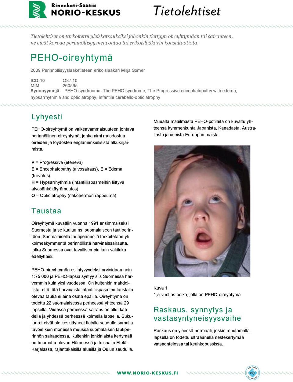 10 MIM 260565 Synonyymejä PEHO-syndrooma, The PEHO syndrome, The Progressive encephalopathy with edema, hypsarrhythmia and optic atrophy, Infantile cerebello-optic atrophy Lyhyesti PEHO-oireyhtymä on