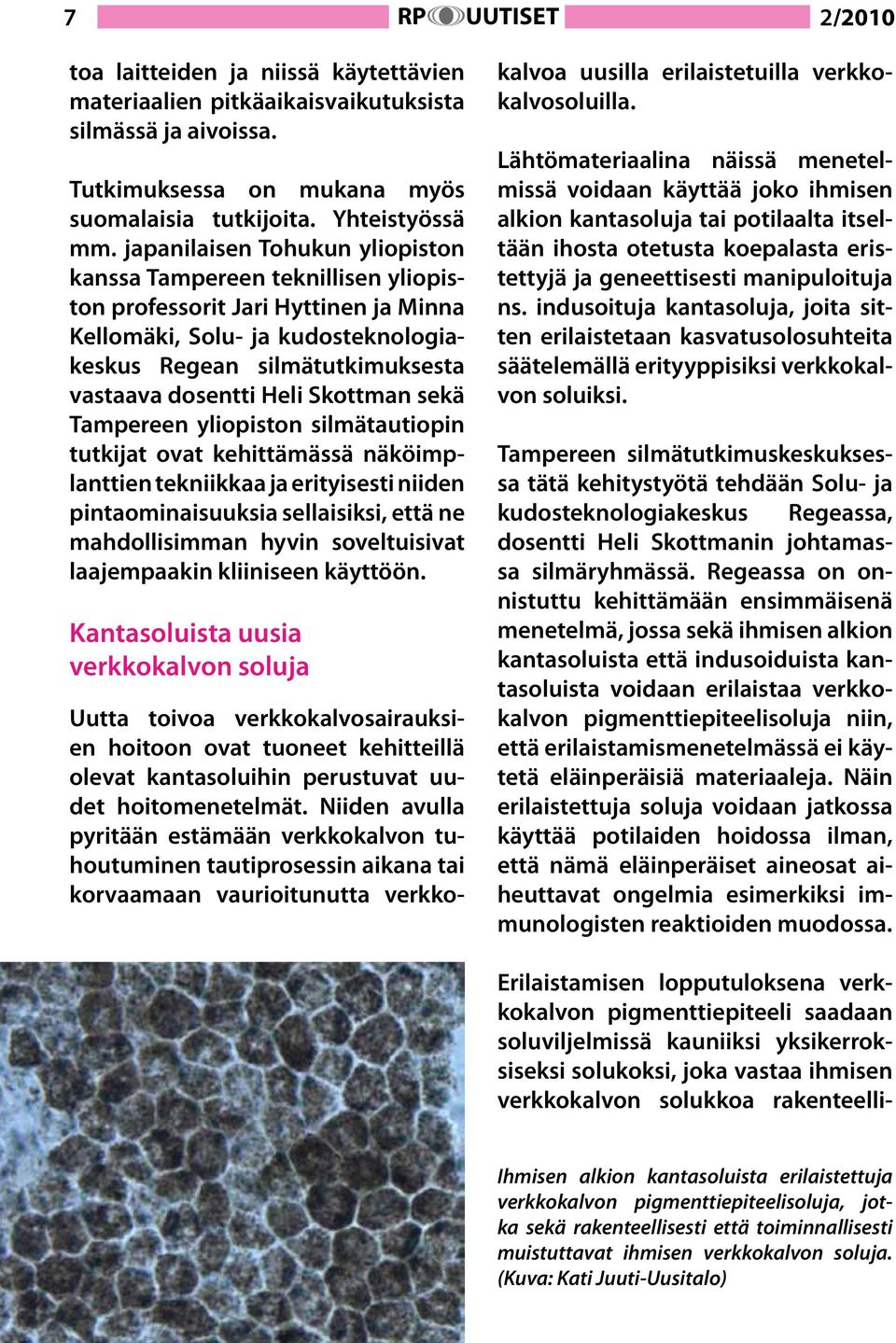 Skottman sekä Tampereen yliopiston silmätautiopin tutkijat ovat kehittämässä näköimplanttien tekniikkaa ja erityisesti niiden pintaominaisuuksia sellaisiksi, että ne mahdollisimman hyvin