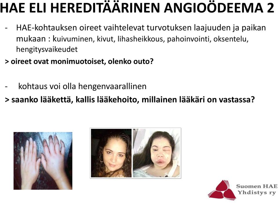 oksentelu, hengitysvaikeudet > oireet ovat monimuotoiset, olenko outo?