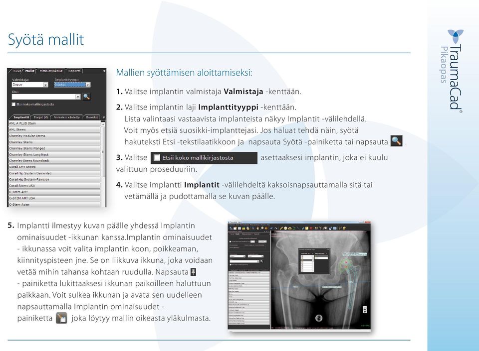 Jos haluat tehdä näin, syötä hakuteksti Etsi -tekstilaatikkoon ja napsauta Syötä -painiketta tai napsauta. 3. Valitse asettaaksesi implantin, joka ei kuulu valittuun proseduuriin. 4.