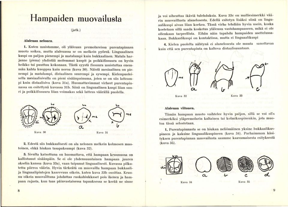 Tästä syystä fissuura muistuttaa enemmän kahta kuoppaa kuin noroa (kuva 30). Näistä mesiaalinen on pienempi ja matalampi, distaalinen suurempi ja syvempi.