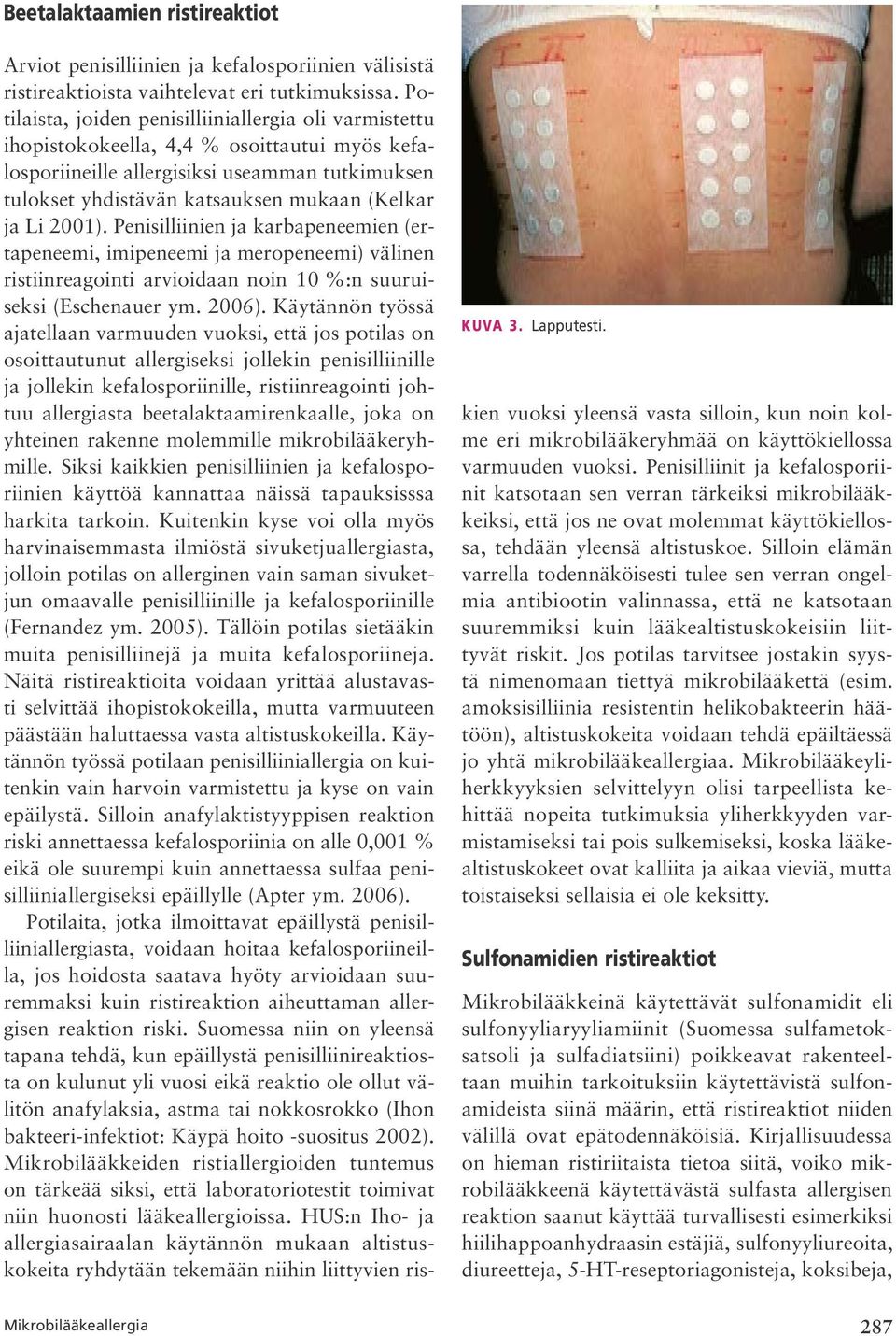 Li 2001). Penisilliinien ja karbapeneemien (ertapeneemi, imipeneemi ja meropeneemi) välinen ristiinreagointi arvioidaan noin 10 %:n suuruiseksi (Eschenauer ym. 2006).