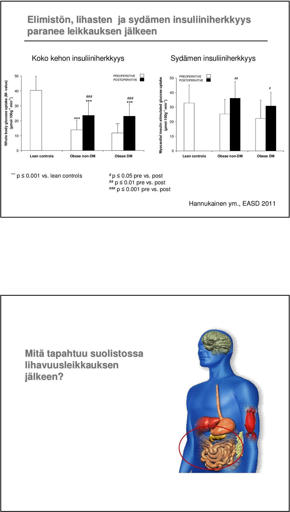 insulin stimulated glucose uptake (µmol 100g -1 min -1 ) 50 40 30 20 10 0 PREOPERATIVE ## POSTOPERATIVE # Lean controls Obese non-dm Obese DM *** p 0.001 vs.