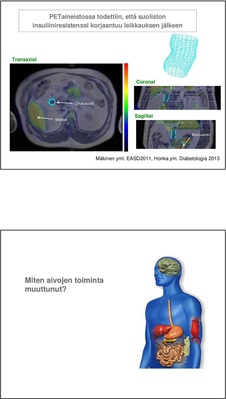 Transaxial Coronal OhutusuoliI Maksar Sagittal Munuainen