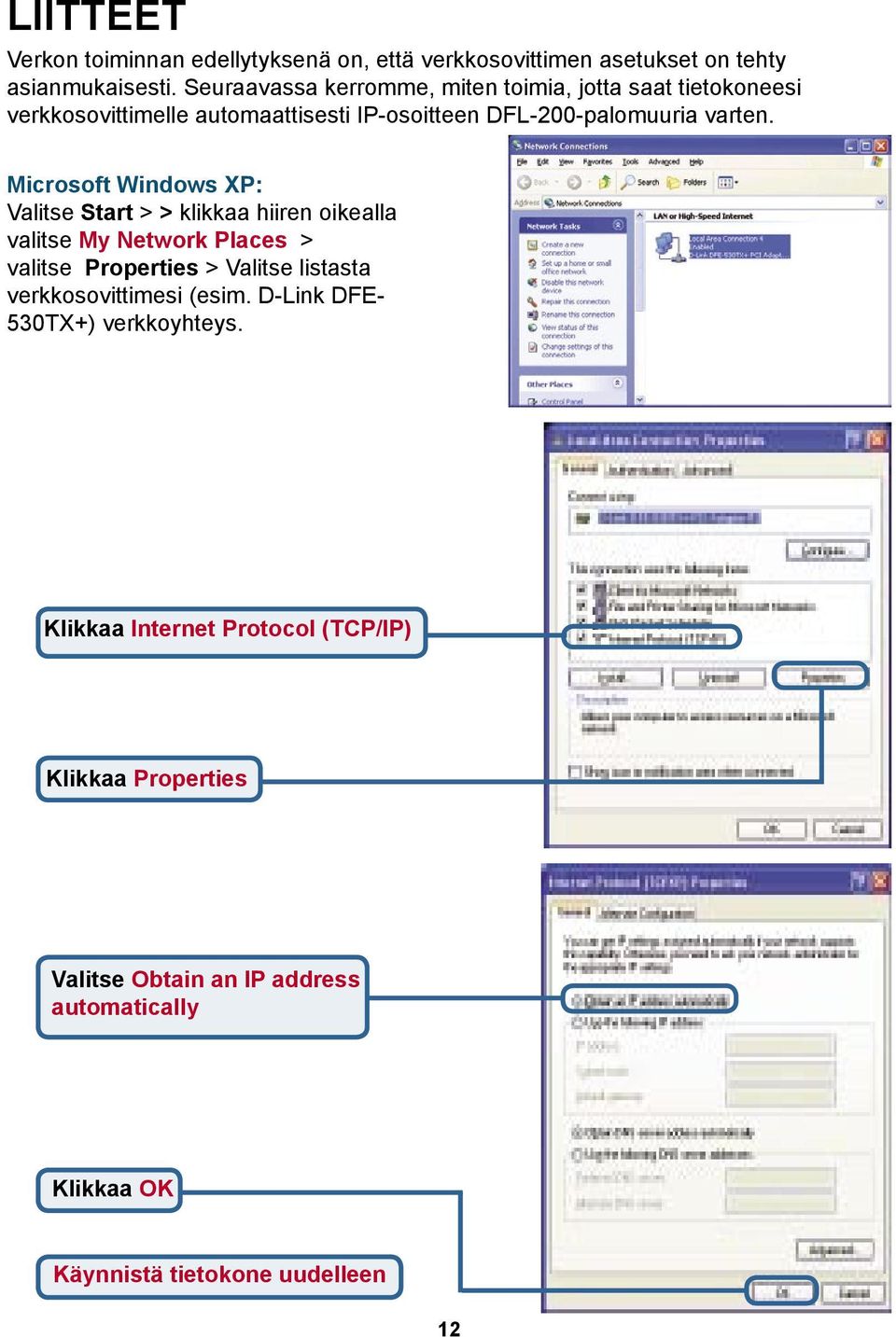 Microsoft Windows XP: Valitse Start > > klikkaa hiiren oikealla valitse My Network Places > valitse Properties > Valitse listasta