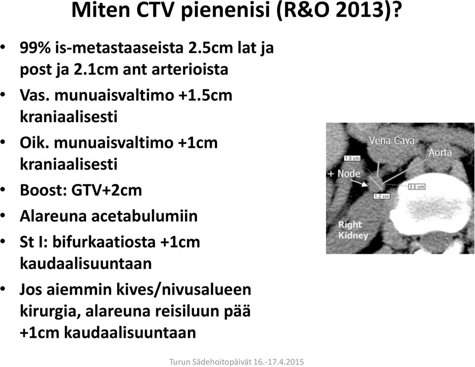 munuaisvaltimo +1cm kraniaalisesti Boost: GTV+2cm Alareuna acetabulumiin St I: