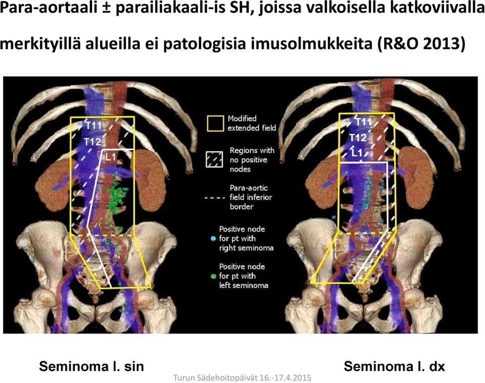 merkityillä alueilla ei patologisia