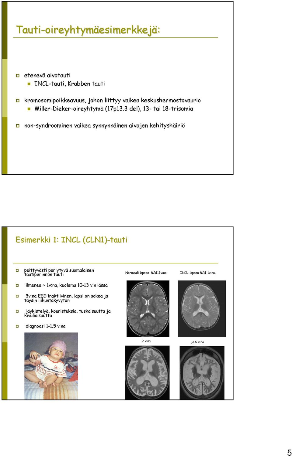 3 del), 13- tai 18-trisomia non-syndroominen vaikea synnynnäinen aivojen kehityshäiriö Esimerkki 1: INCL (CLN1)-tauti peittyvästi periytyvä suomalaisen