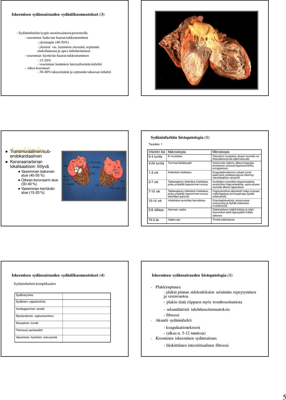 ja septumin takaosan infarkti Sydäninfarktin histopatologia (1) Transmuraalinen/subendokardiaalinen Luokittelu Koronaariarterian lokalisaatioon liittyvä Vasemman laskevan alue (40-50 %) Oikean