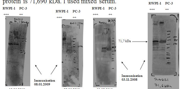 43 RAD21 Testattavana vasta-aineena oli kaikissa kolmessa testauksessa #EP84mix, jonka kohdeproteiini oli RAD21. Vasta-aineiden immunisointi- ajankohta oli kohdissa 1. 08.01.2009, 2. 08.01.2009, 3.