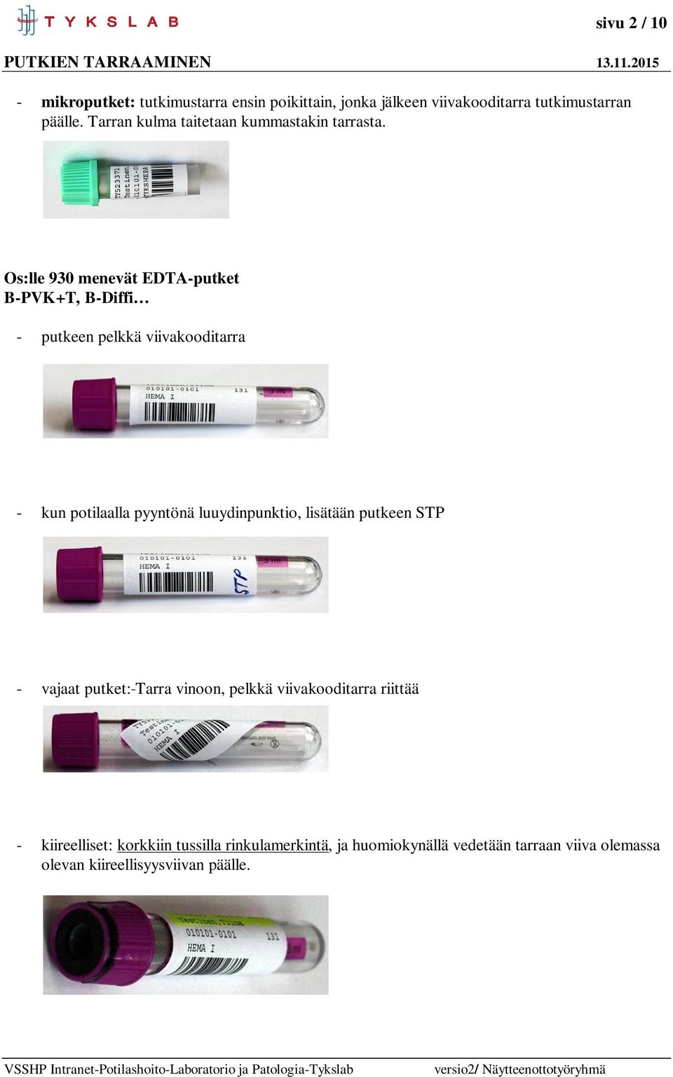 Os:lle 930 menevät EDTA-putket B-PVK+T, B-Diffi - putkeen pelkkä viivakooditarra - kun potilaalla pyyntönä luuydinpunktio,