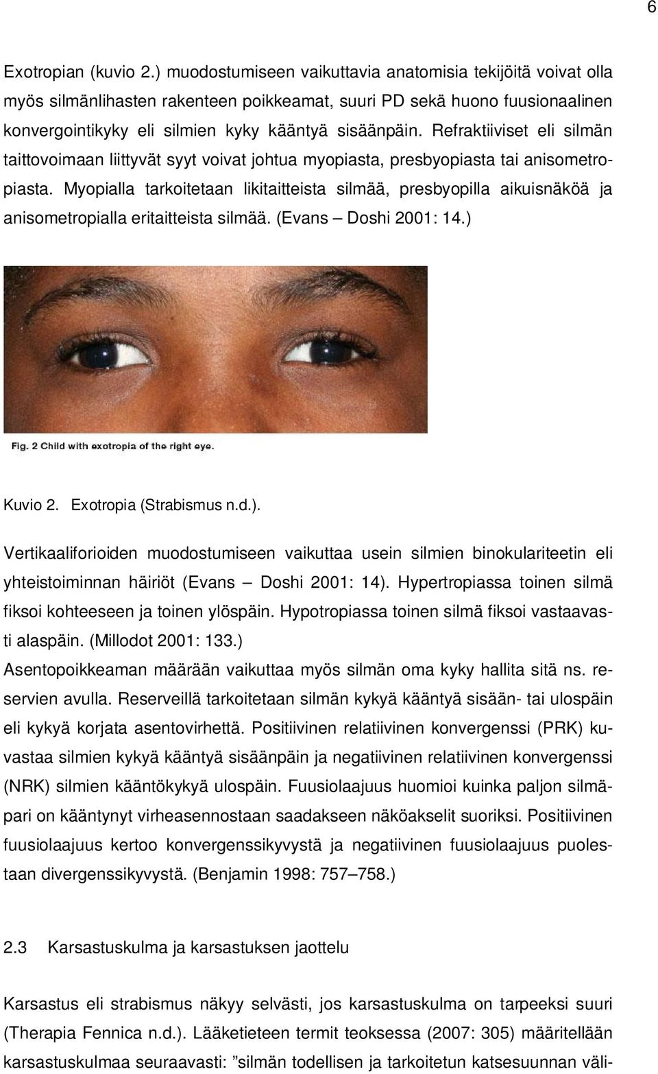 Refraktiiviset eli silmän taittovoimaan liittyvät syyt voivat johtua myopiasta, presbyopiasta tai anisometropiasta.