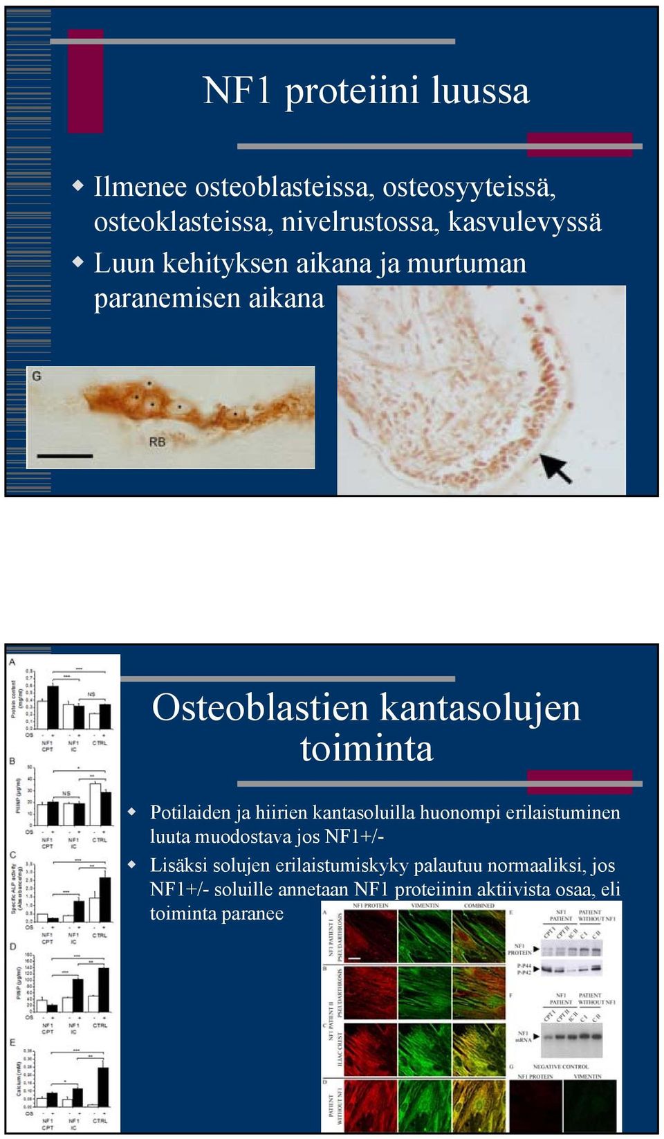 Potilaiden ja hiirien kantasoluilla huonompi erilaistuminen luuta muodostava jos NF1+/- Lisäksi solujen