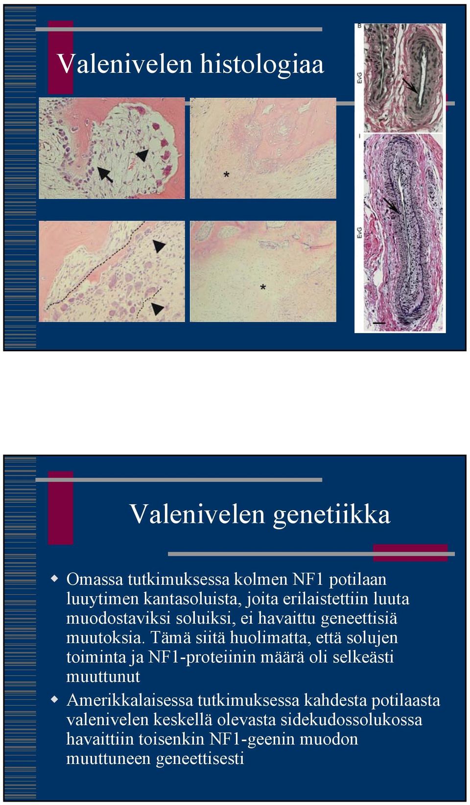 Tämä siitä huolimatta, että solujen toiminta ja NF1-proteiinin määrä oli selkeästi muuttunut Amerikkalaisessa