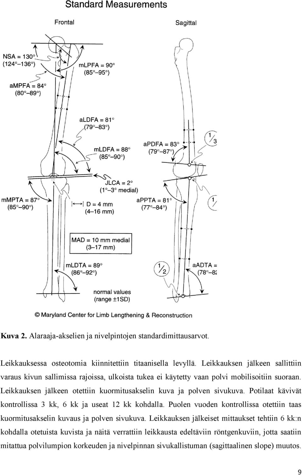 Leikkauksen jälkeen otettiin kuormitusakselin kuva ja polven sivukuva. Potilaat kävivät kontrollissa 3 kk, 6 kk ja useat 12 kk kohdalla.