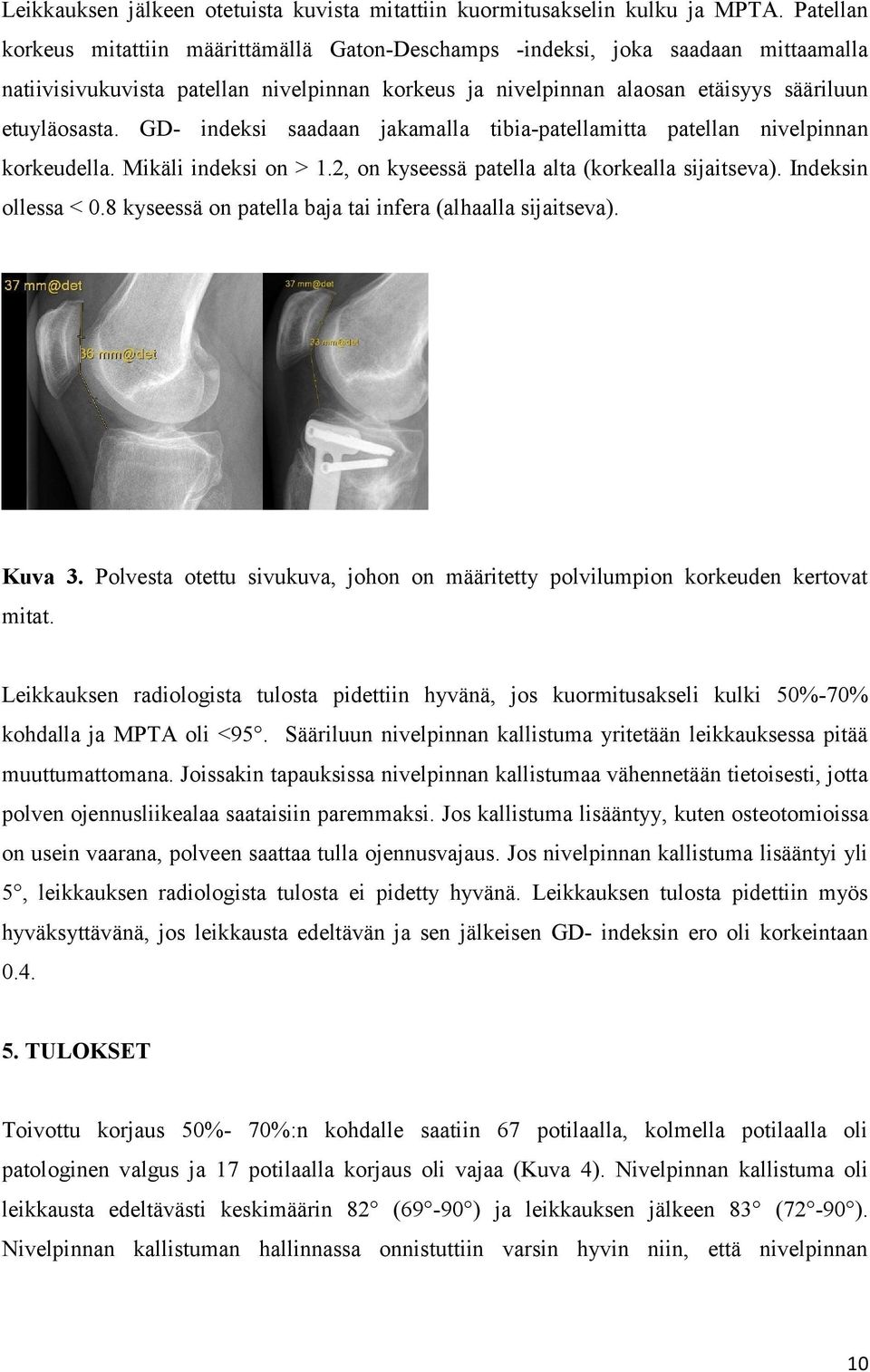 GD- indeksi saadaan jakamalla tibia-patellamitta patellan nivelpinnan korkeudella. Mikäli indeksi on > 1.2, on kyseessä patella alta (korkealla sijaitseva). Indeksin ollessa < 0.