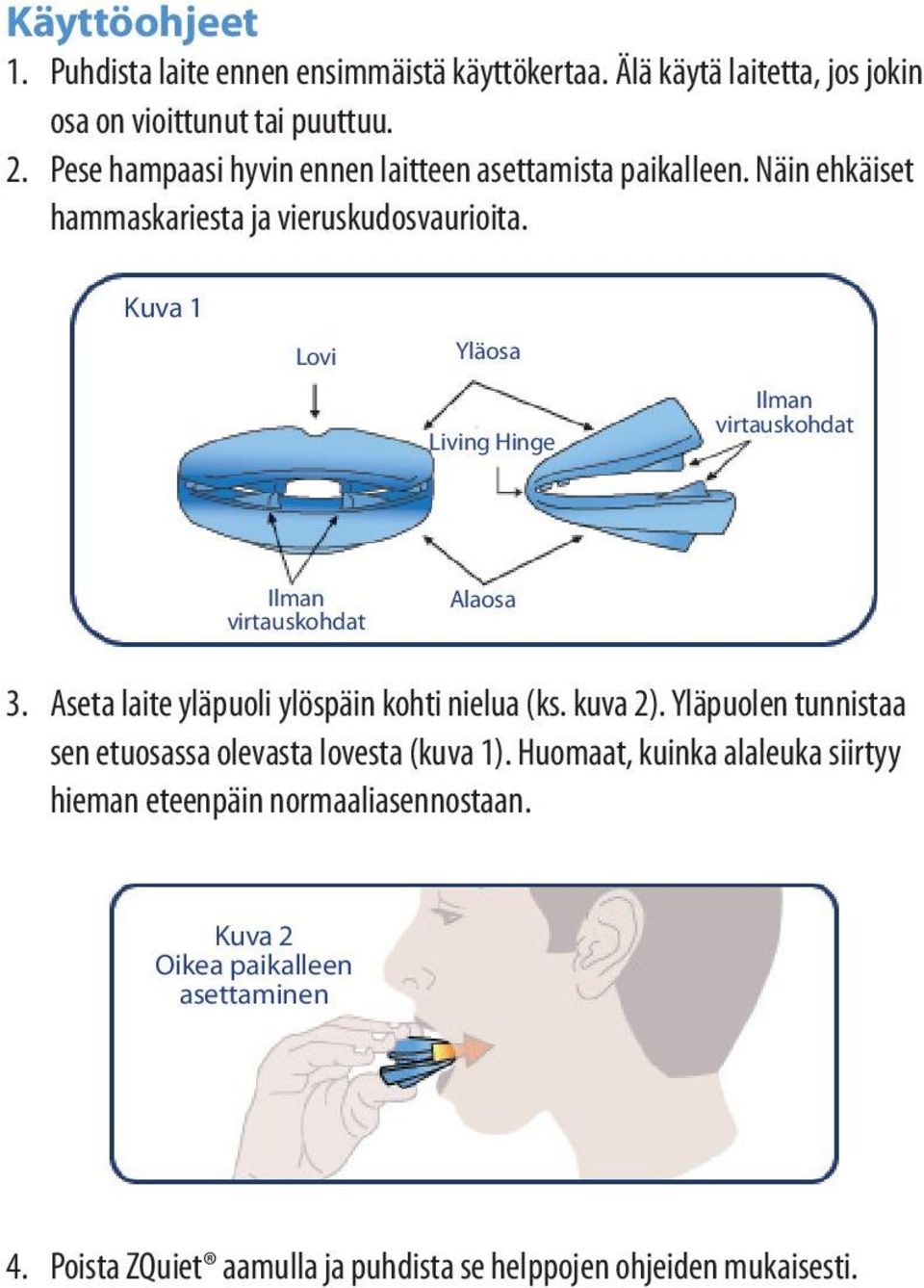 Kuva 1 Lovi Yläosa Living Hinge Ilman virtauskohdat Ilman virtauskohdat Alaosa 3. Aseta laite yläpuoli ylöspäin kohti nielua (ks. kuva 2).