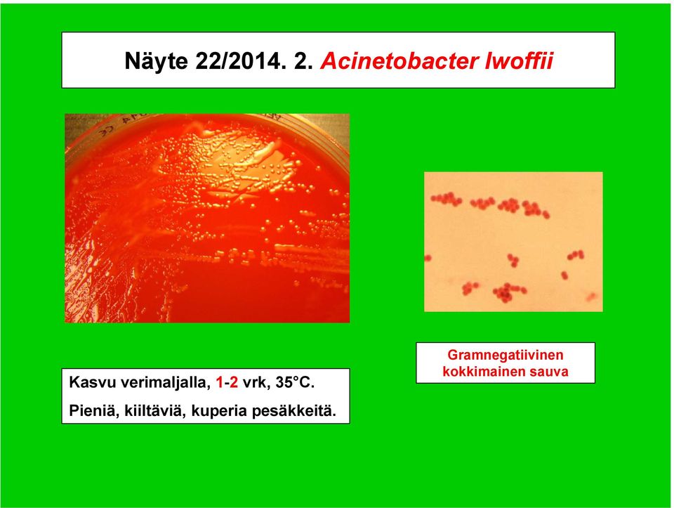 Acinetobacter lwoffii Kasvu