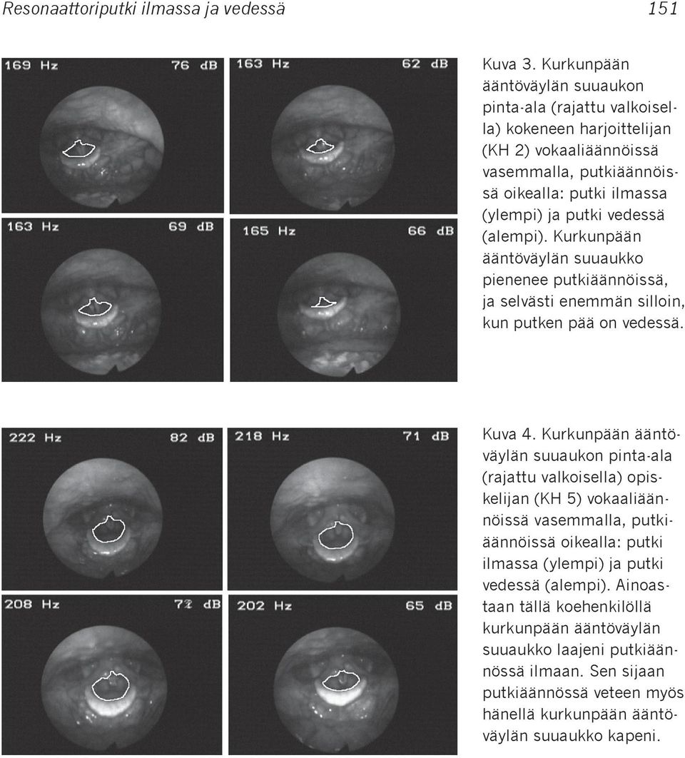 vedessä (alempi). Kurkunpään ääntöväylän suuaukko pienenee putkiäännöissä, ja selvästi enemmän silloin, kun putken pää on vedessä. Kuva 4.