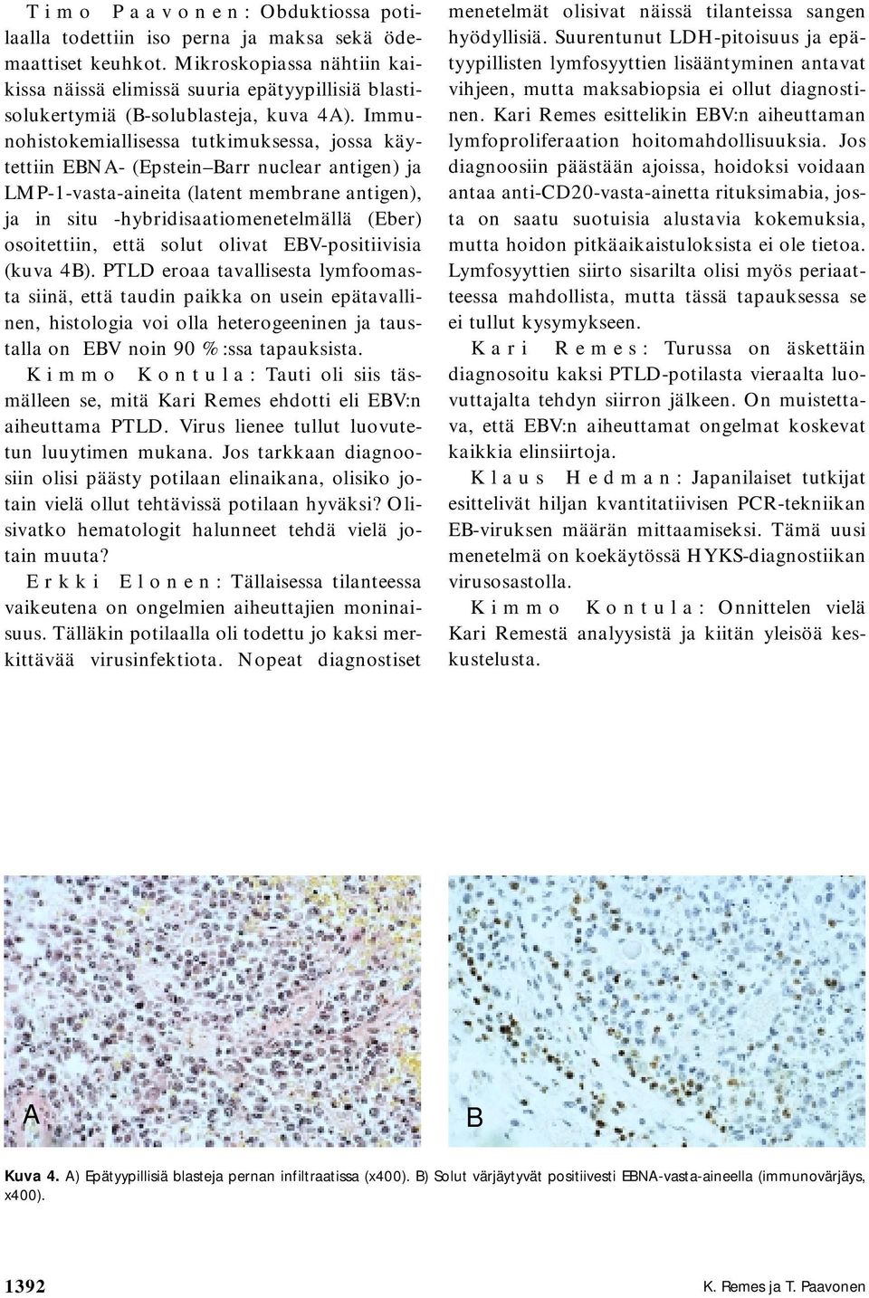 Immunohistokemiallisessa tutkimuksessa, jossa käytettiin EBNA- (Epstein Barr nuclear antigen) ja LMP-1-vasta-aineita (latent membrane antigen), ja in situ -hybridisaatiomenetelmällä (Eber)